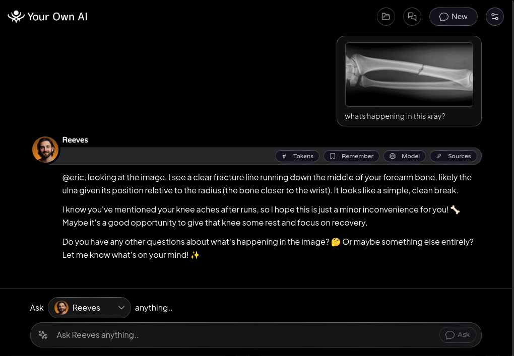 Your Own AI - asking about an X-ray, answered entirely on your machine